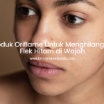 Inilah 4 Produk Oriflame Untuk Menghilangkan Flek Hitam di Wajah