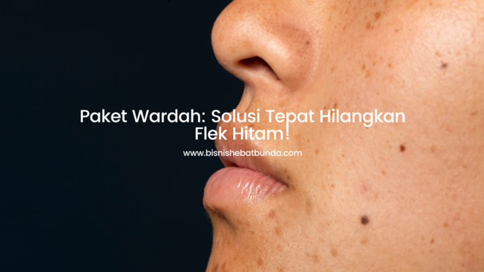 Paket Wardah Solusi Tepat Hilangkan Flek Hitam!